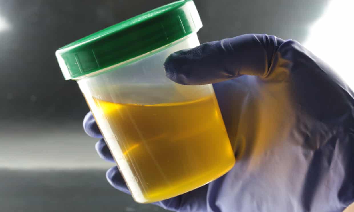 Drinking your own urine? There’s a Facebook group for that. Two, even (theguardian.com)