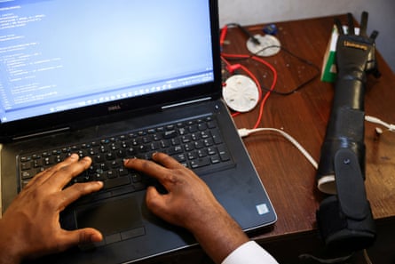 ‘Próteses não são feitas para pessoas como nós’: os irmãos criando próteses artificiais inovadoras...