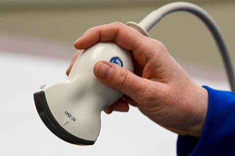 a hand holds an ultrasound probe