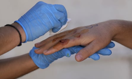 A volunteer gives the first aid to an injured Afghan refugee following the rescue.