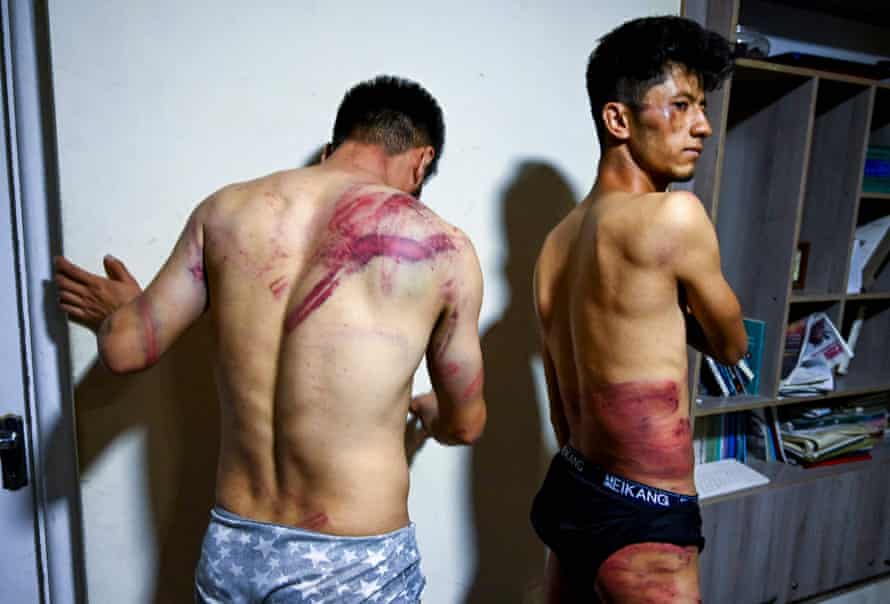Agency photographer of the year – 2021 shortlist | World news 59 Afghan newspaper Etilaat Roz journalists Nematullah Naqdi and Taqi Daryabi show their wounds in their office in Kabul after being released from Taliban custody