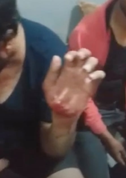 Screengrab from the prisoner-shot video showing injuries to his fellow detainees.