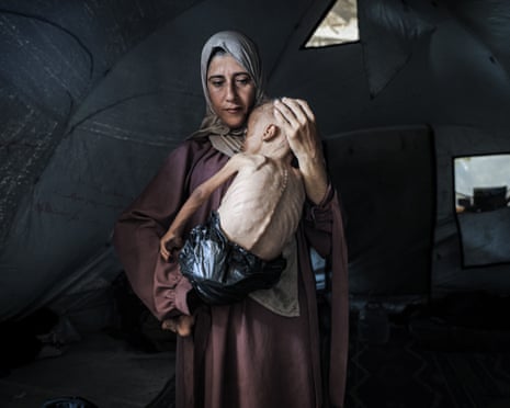 A one-and-a-half-year-old child in Gaza facing life-threatening malnutrition as the humanitarian situation worsens due to ongoing Israeli attacks and blockade.