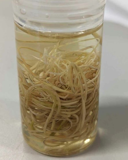 The vial of nematodes from the museum in Launceston, Tasmania