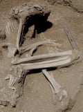 A woman’s skeleton with fractures