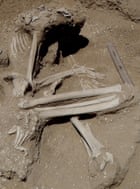 A woman’s skeleton with fractures