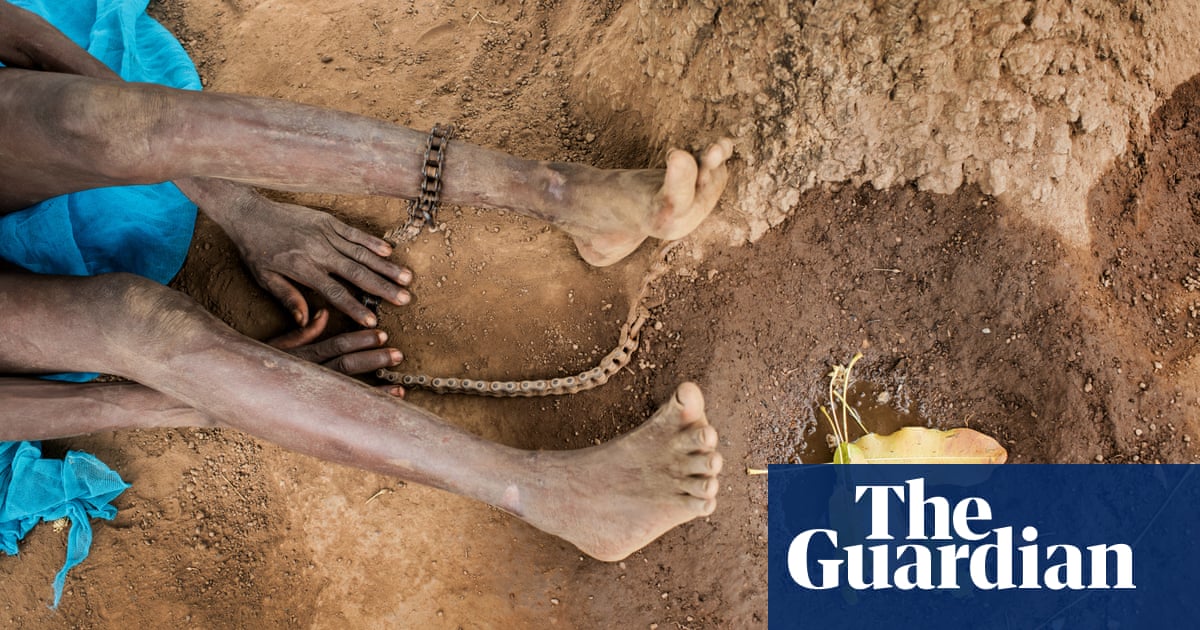 'All we can offer is the chain': the scandal of Ghana's shackled sick - The Guardian