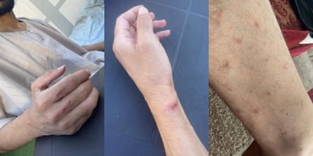Triple composite picture showing person’s limbs with apparent injuries