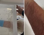 Mosquito colony feeds on blood from scientist's arm – video