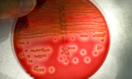 Methicillin-resistant Staphylococcus aureus colonies