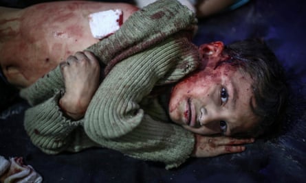 A young Syrian receives first aid after what local activists say was an airstrike by pro-Assad loyalists on Douma.