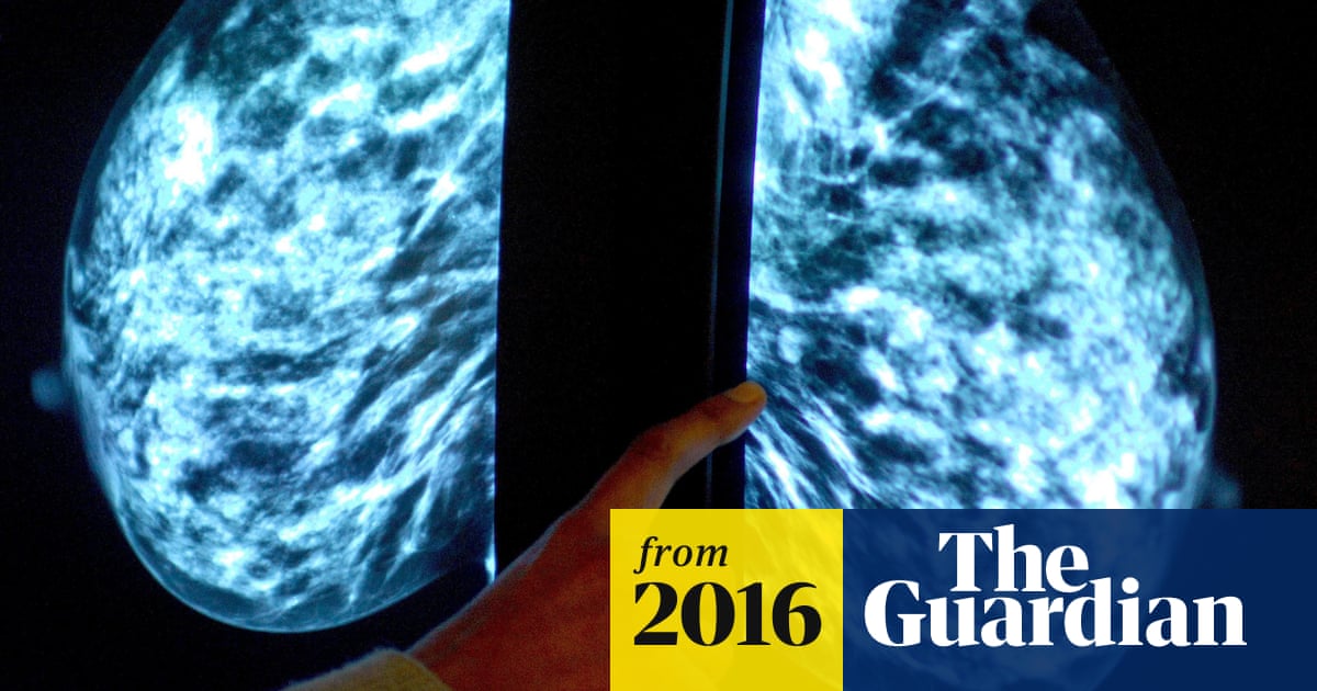 Breast cancer cell growth halted by osteoporosis drug, study shows