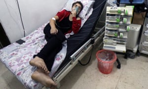 A civilian breathes through an oxygen mask after an alleged chlorine gas attack in Aleppo.
