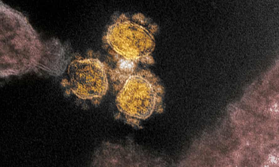 Sars-CoV-2 virus image
