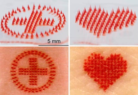 Microneedle tattoo designs and their imprints of a medical-alert cross in a circle, and of a heart.