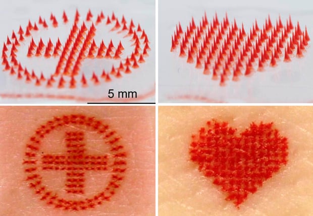 Microneedling tattoo designs and their imprints in the form of a medical cross in a circle and a heart.