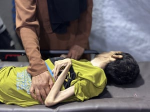 Khan Yunis, GazaThe body of 29-year-old Palestinian Ayyub Sabir Abu al-Hasin is brought to Kuwait hospital for funeral procedures after he died of malnutrition