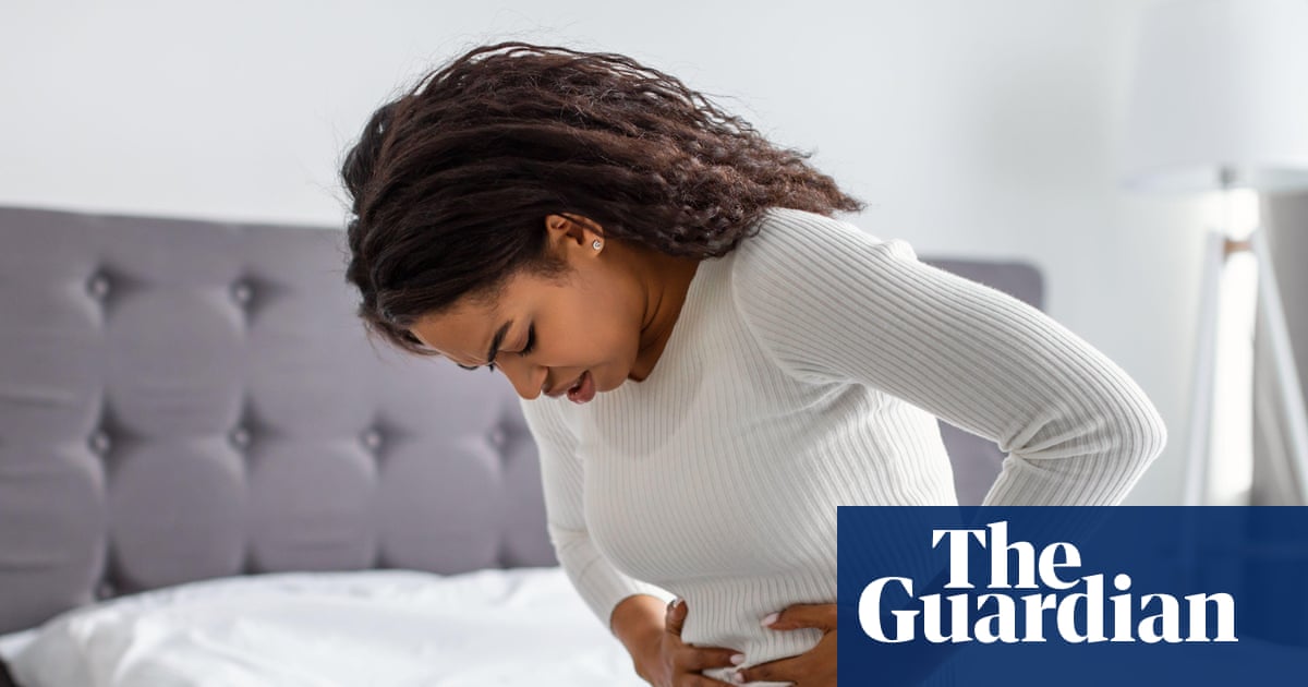 Black women with fibroids face delays and poor care in the UK, says report