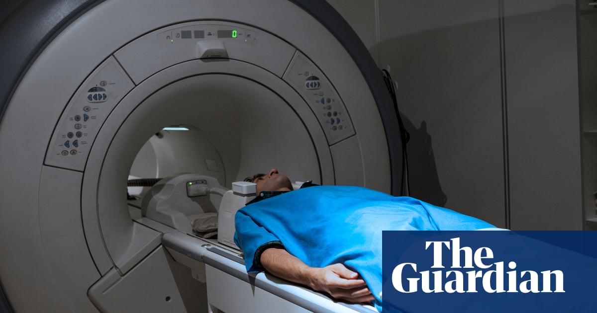 Millions in west do not know they have aggressive fatty liver disease, study says
