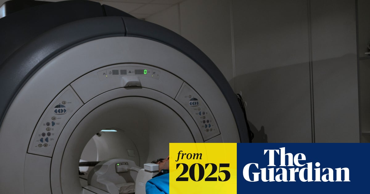 Millions in west do not know they have aggressive fatty liver disease, study says