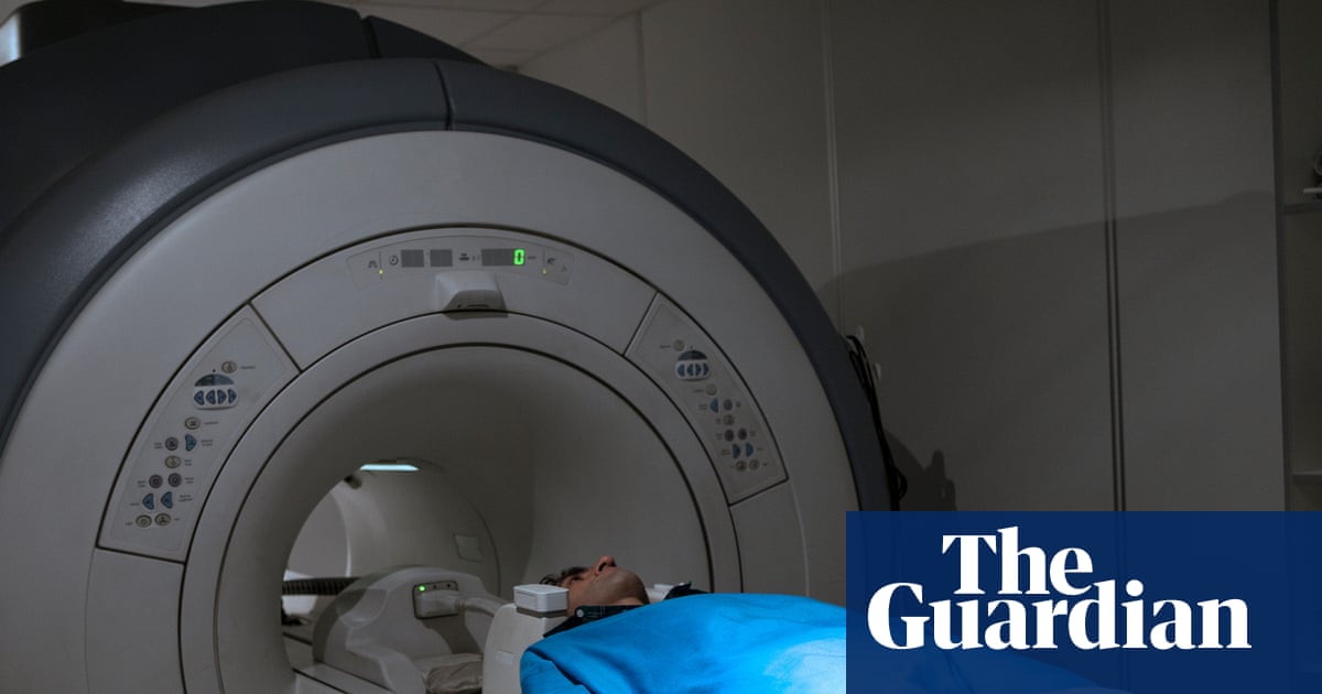 Millions in west do not know they have aggressive fatty liver disease, study says
