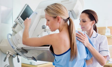 Mammograms may not need that painful 'squish'. Should I be