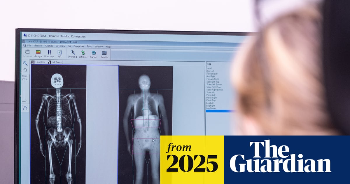 Full-body scans of 100,000 people could change way diseases are detected and treated