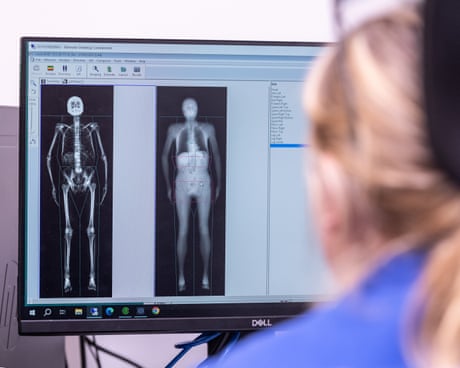 A medical professional looks at a scan of a human body on a computer screen.