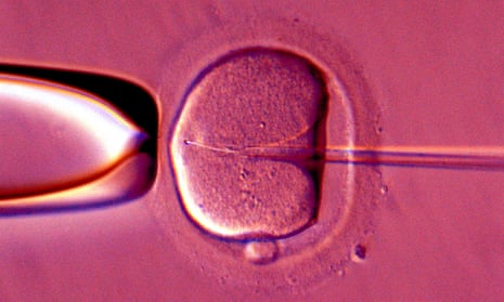 artificial insemination under microscope