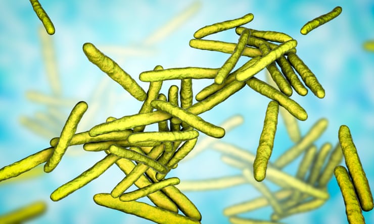 Una ilustración por computadora de la bacteria Mycobacterium leprae.  Fotografía: Kateryna Kon/Getty Images/Science Photo Library RF