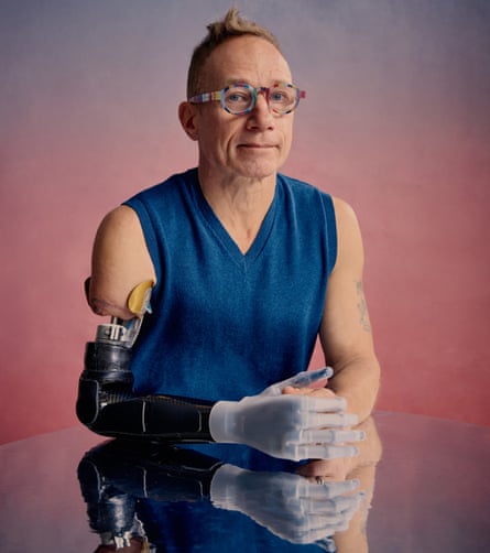 Jim Ashworth-Beaumont photographed successful March 2025 pinch his caller manually adapted prosthetic arm