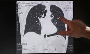 lungs