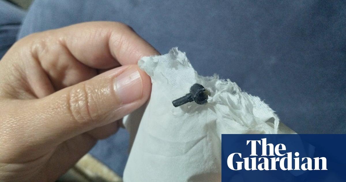 Lego piece falls out of New Zealand boy's nose after being stuck for two years