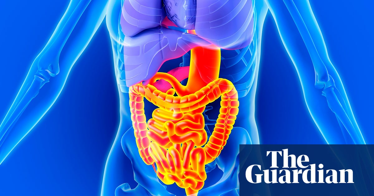 Everything you've ever wanted to know about my colonoscopy (but never dared  to ask) | Anxiety | The Guardian Everything you've ever wanted to know about my colonoscopy (but never dared  to ask) | Anxiety | The Guardian