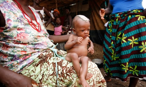 A six-month-old baby whose mother died in childbirth is cared for by his grandmother in Freetown, Sierra Leone