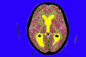 A brain scan of a patient with Alzheimer’s.