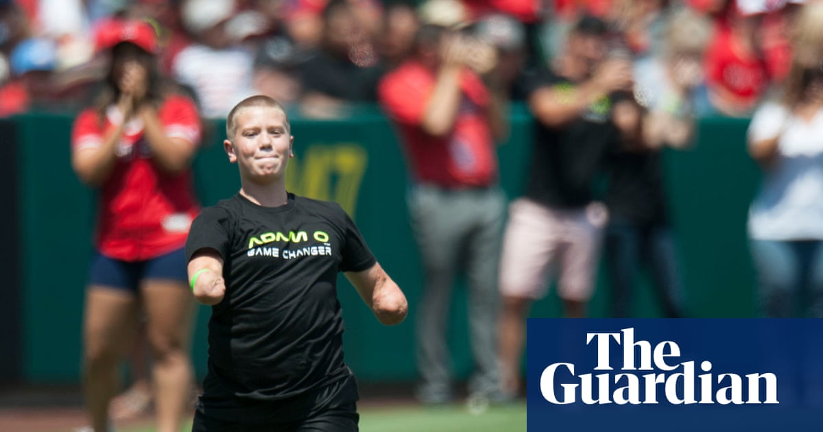 Quadruple amputee cornhole pro says he fatally shot person in self-defense