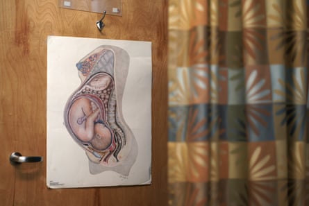 A pink and blue cross section of a pregnant person’s body, with the fetus’s head positioning toward the vaginal canal.