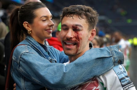 Nick David, the Harlequins wing who received a nasty eye injury but carried on playing, gets a hug from his girlfriend as he celebrates victory after the Premiership match against Saracens at the Tottenham Hotspur Stadium.