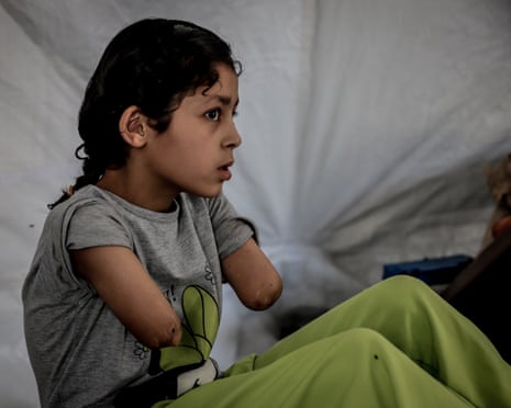 10-year-old Palestinian Sarah Al-Barsh, who lost both of her arms in an Israeli attack.