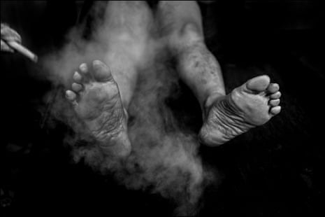 Steam is directed at a person’s feet and bare legs