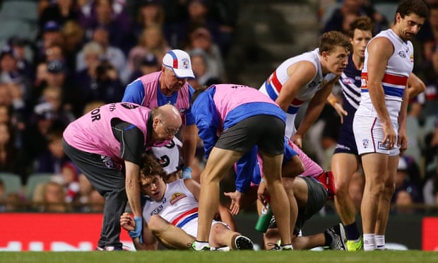Former Western Bulldogs player Liam Picken is assisted off the field after a concussion in 2017.