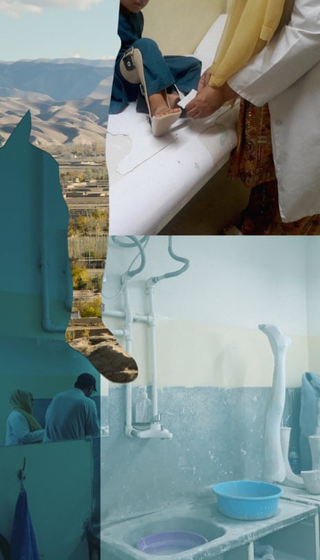Composite of prosthetic legs and medical apparatus for people with broken or injured legs