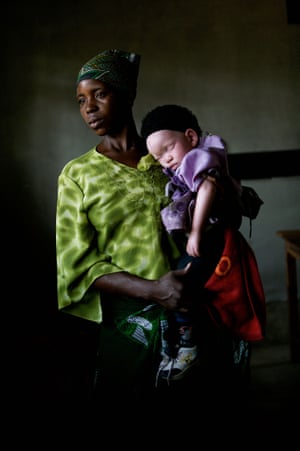 Tanzanians Siwema Selestine and her daughter. Film-maker Harry Freeland, who took this portrait, set up the charity Standing Voice after making a documentary about albinism in Tanzania.