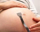 Scientists create wearable ultrasound to continuously monitor babies in womb