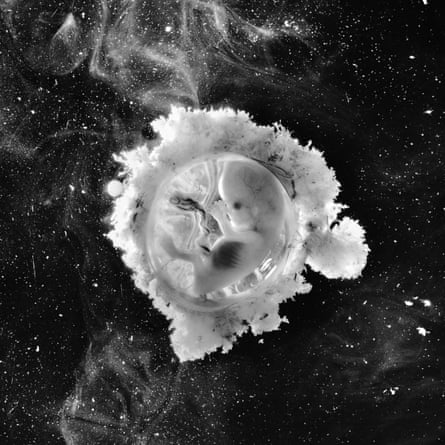 Foetus 13 weeks, (Spaceman) .