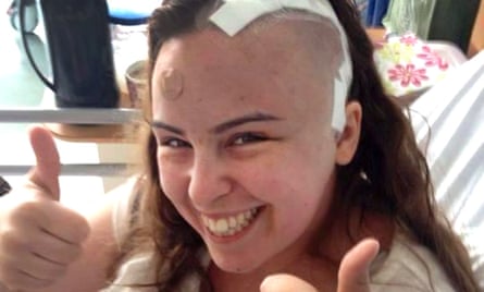 Frances Paine, a junior doctor who had brain surgery while awake to remove a tumour