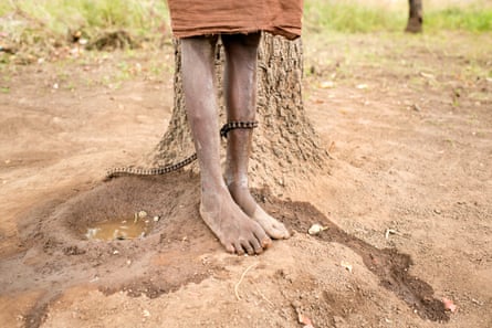 Umama Belakoba does not know her age. She has schizophrenia and is cared for by her mother at Nyinbunya prayer camp and Pentecostal Church in northern Ghana, where she has been chained for a year to a shea tree. She has four children.