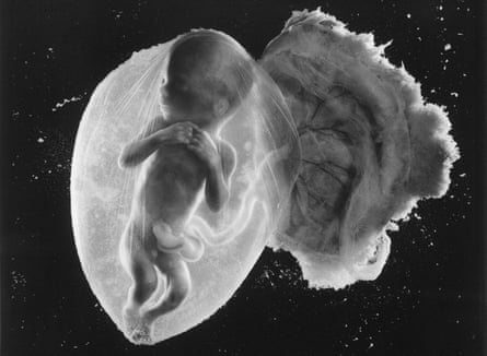 Prenatal journey … Foetus 18 weeks, by Lennart Nilsson.
