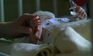 When To End A Terminally Ill Child S Life It S An Agonising